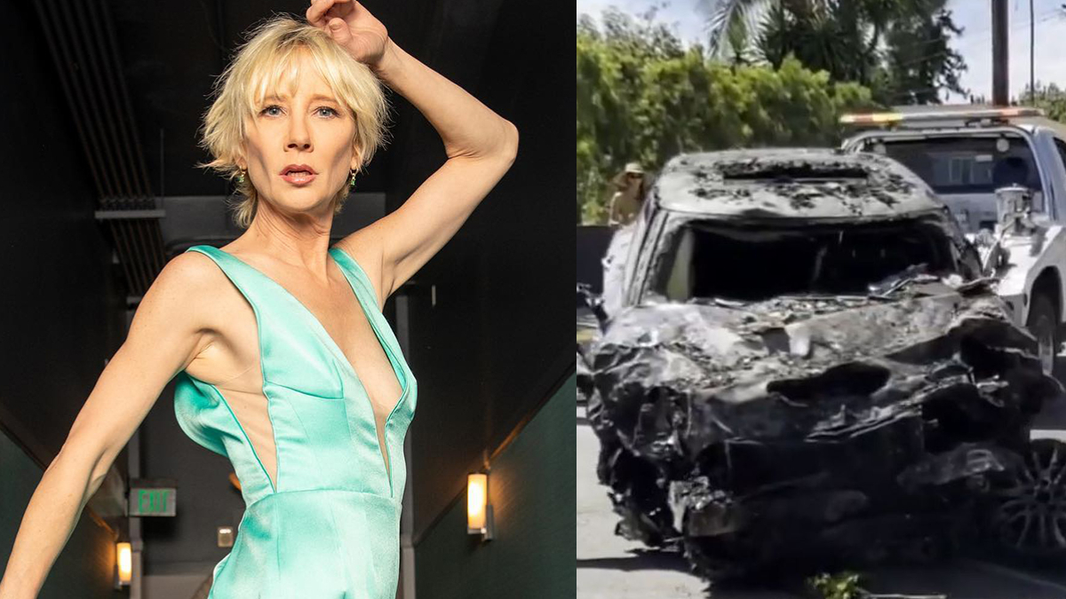 After A Car Crash, Anne Heche Is In ‘extreme Critical Condition
